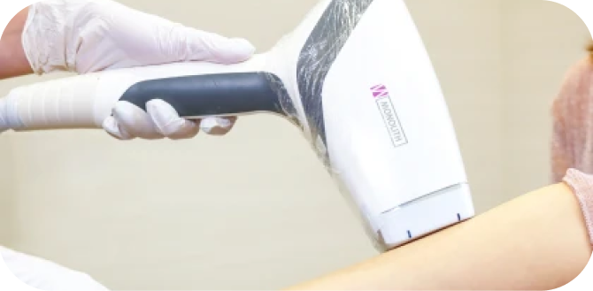 契約前の無料テスト照射で痛み等を確認できる