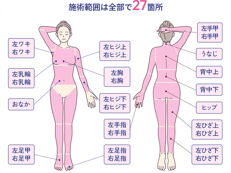 施術範囲は全部で27箇所。左右のワキ、左右のヒジ上、左右のヒジ下、左右の手の甲、左右の手指、うなじ、背中、ヒップ、左右の胸、左右の乳輪、おなか、左右のひざ上、左右のひざ下、左右の足の甲、左右の足指。